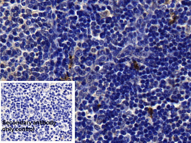Tryptase Antibody in Immunohistochemistry (Paraffin) (IHC (P))