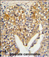 LUM Antibody in Immunohistochemistry (Paraffin) (IHC (P))
