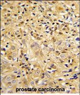 LUM Antibody in Immunohistochemistry (Paraffin) (IHC (P))