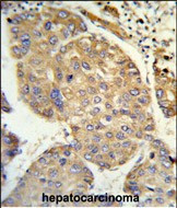 PHACTR2 Antibody in Immunohistochemistry (Paraffin) (IHC (P))