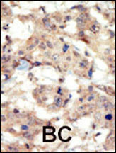 EphB6 Antibody in Immunohistochemistry (Paraffin) (IHC (P))