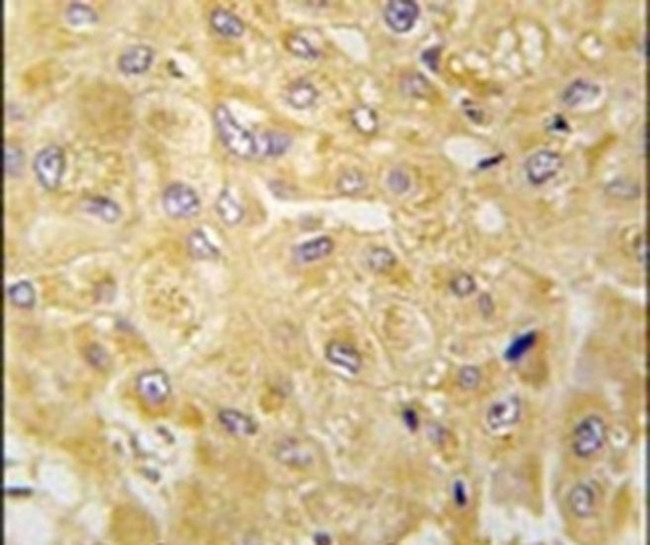 ILK Antibody in Immunohistochemistry (Paraffin) (IHC (P))