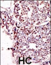 TYRO3 Antibody in Immunohistochemistry (Paraffin) (IHC (P))