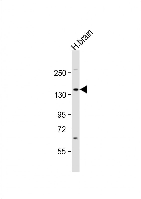TrkA Antibody in Western Blot (WB)