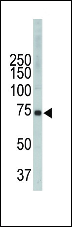 ITK Antibody in Western Blot (WB)