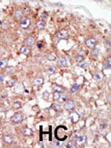 BRK Antibody in Immunohistochemistry (Paraffin) (IHC (P))