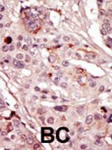 SRMS Antibody in Immunohistochemistry (Paraffin) (IHC (P))