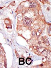 TNK1 Antibody in Immunohistochemistry (Paraffin) (IHC (P))