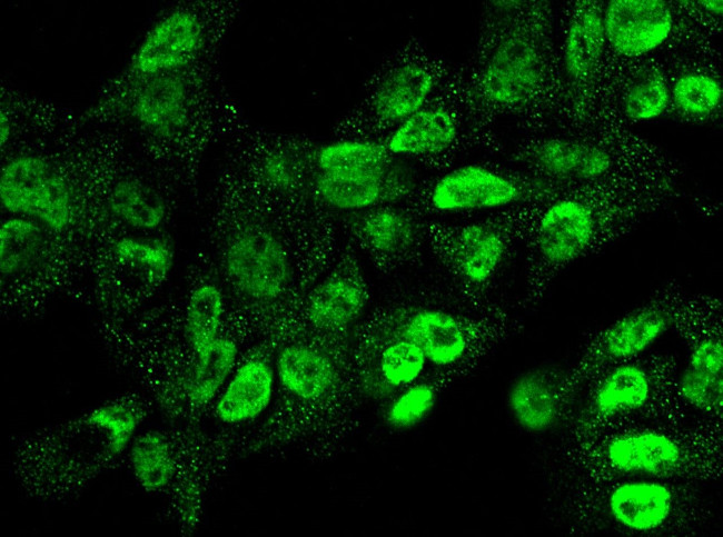 RSK2 Antibody in Immunocytochemistry (ICC/IF)