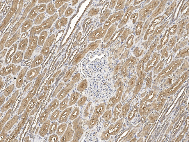 SLC52A1 Antibody in Immunohistochemistry (Paraffin) (IHC (P))