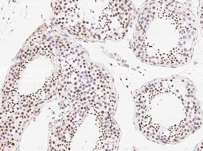 HOXA10 Antibody in Immunohistochemistry (Paraffin) (IHC (P))