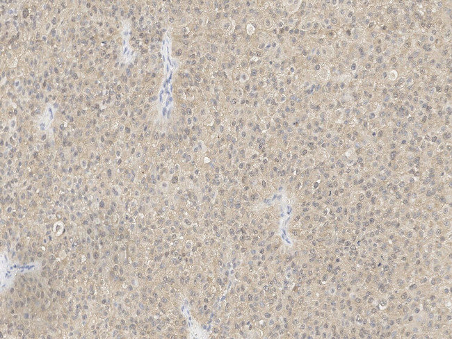 NUDT5 Antibody in Immunohistochemistry (Paraffin) (IHC (P))