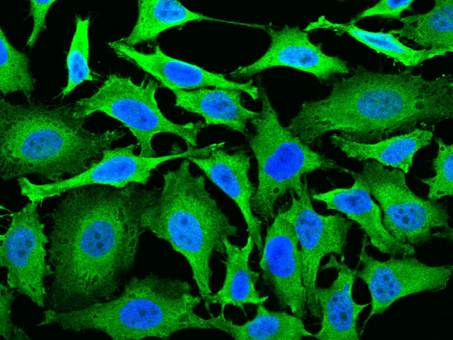 TRPC7 Antibody in Immunocytochemistry (ICC/IF)