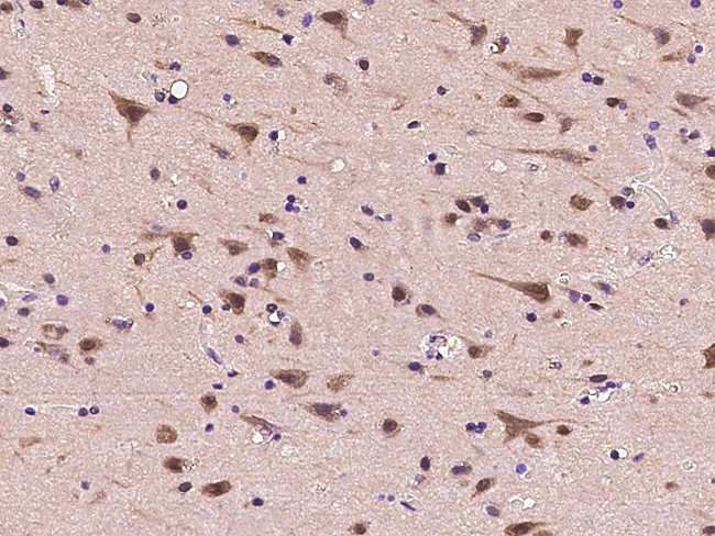 PSMC2 Antibody in Immunohistochemistry (Paraffin) (IHC (P))