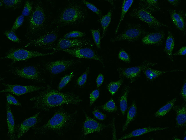 VWF Antibody in Immunocytochemistry (ICC/IF)