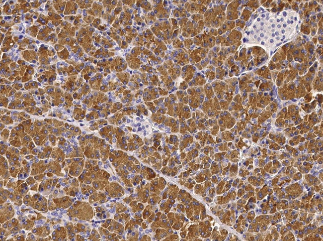 Chymotrypsin Antibody in Immunohistochemistry (Paraffin) (IHC (P))