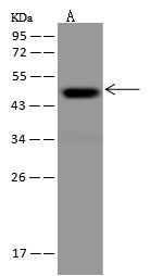 CRELD1 Antibody in Western Blot (WB)