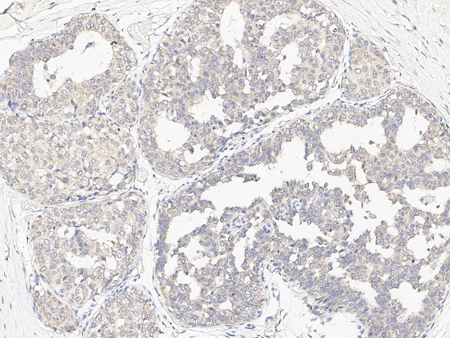 SMPDL3A Antibody in Immunohistochemistry (Paraffin) (IHC (P))