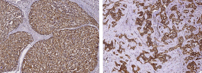 PPCDC Antibody in Immunohistochemistry (Paraffin) (IHC (P))