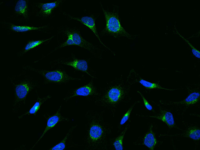 ARF3 Antibody in Immunocytochemistry (ICC/IF)