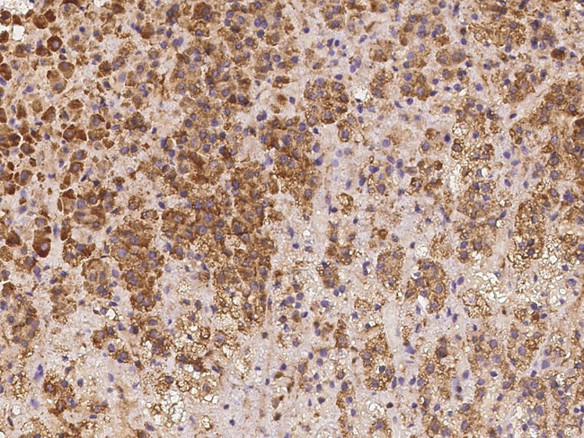LRRC19 Antibody in Immunohistochemistry (Paraffin) (IHC (P))