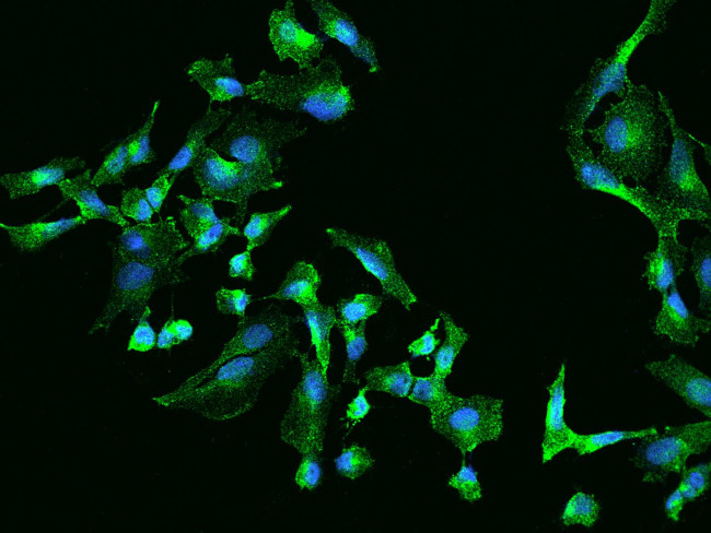 Clathrin Light Chain A Antibody in Immunocytochemistry (ICC/IF)