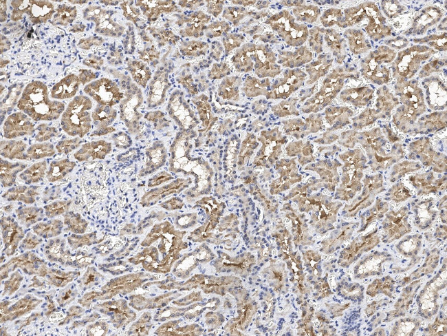 PSMD4 Antibody in Immunohistochemistry (Paraffin) (IHC (P))