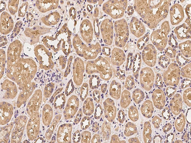 PPM1B Antibody in Immunohistochemistry (Paraffin) (IHC (P))