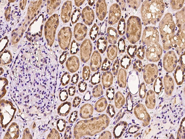 SNX31 Antibody in Immunohistochemistry (Paraffin) (IHC (P))