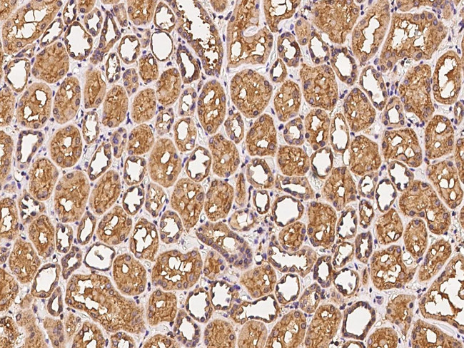 CLRN3 Antibody in Immunohistochemistry (Paraffin) (IHC (P))
