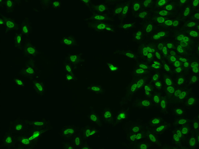 CTDSP2 Antibody in Immunocytochemistry (ICC/IF)
