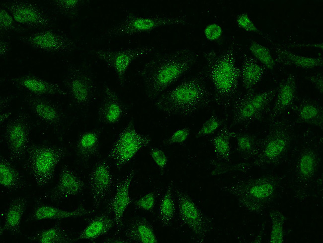 AMMECR1 Antibody in Immunocytochemistry (ICC/IF)