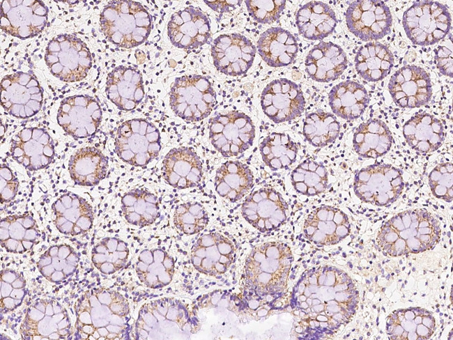 AS3MT Antibody in Immunohistochemistry (Paraffin) (IHC (P))