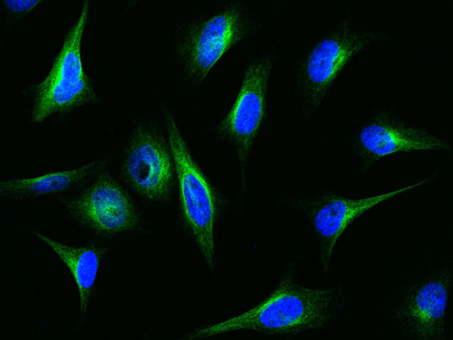 IFIT1 Antibody in Immunocytochemistry (ICC/IF)