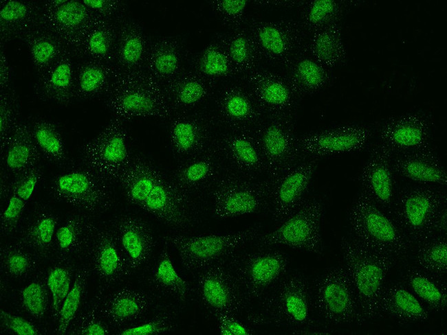 TMEM38A Antibody in Immunocytochemistry (ICC/IF)