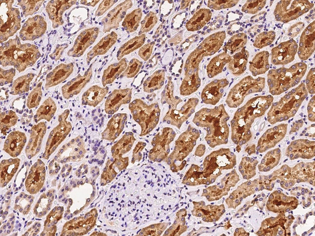 TRAK1 Antibody in Immunohistochemistry (Paraffin) (IHC (P))
