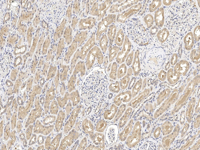 SNX3 Antibody in Immunohistochemistry (Paraffin) (IHC (P))