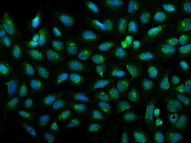 CCDC25 Antibody in Immunocytochemistry (ICC/IF)