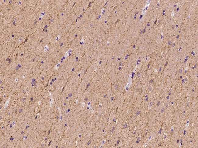 SLC4A10 Antibody in Immunohistochemistry (Paraffin) (IHC (P))