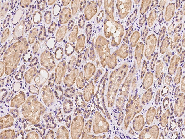 PET117 Antibody in Immunohistochemistry (Paraffin) (IHC (P))