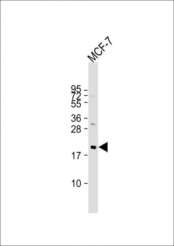 N-Ras Antibody in Western Blot (WB)