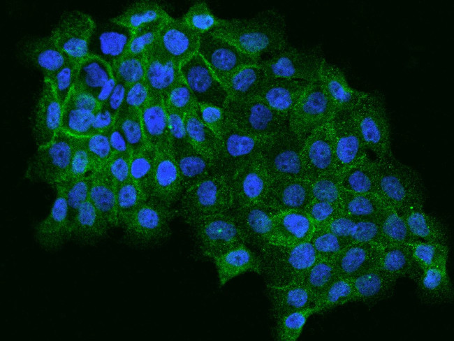 ALS2CR12 Antibody in Immunocytochemistry (ICC/IF)