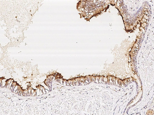 C5orf49 Antibody in Immunohistochemistry (Paraffin) (IHC (P))