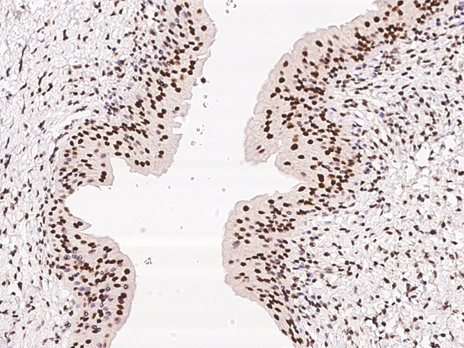 ZNF512B Antibody in Immunohistochemistry (Paraffin) (IHC (P))