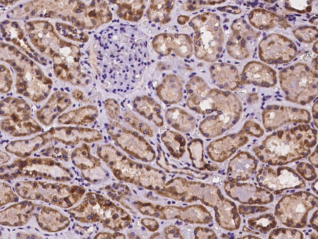 TMEM143 Antibody in Immunohistochemistry (Paraffin) (IHC (P))