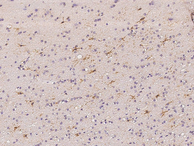 TRIM64C Antibody in Immunohistochemistry (Paraffin) (IHC (P))