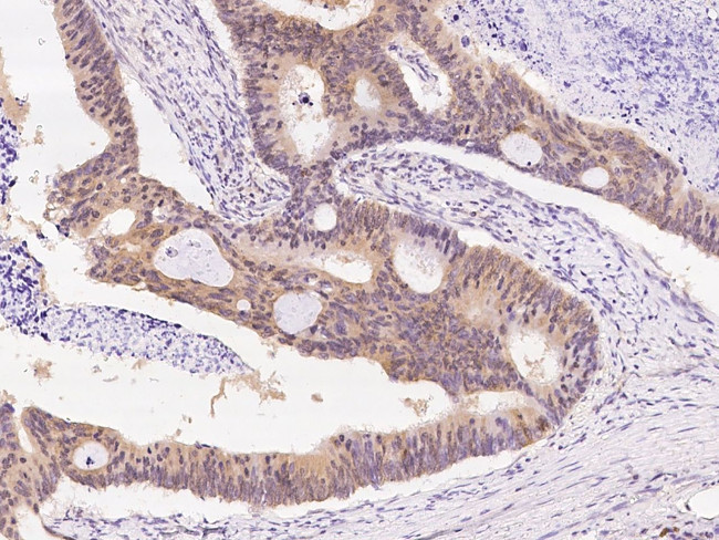 PCF11 Antibody in Immunohistochemistry (Paraffin) (IHC (P))