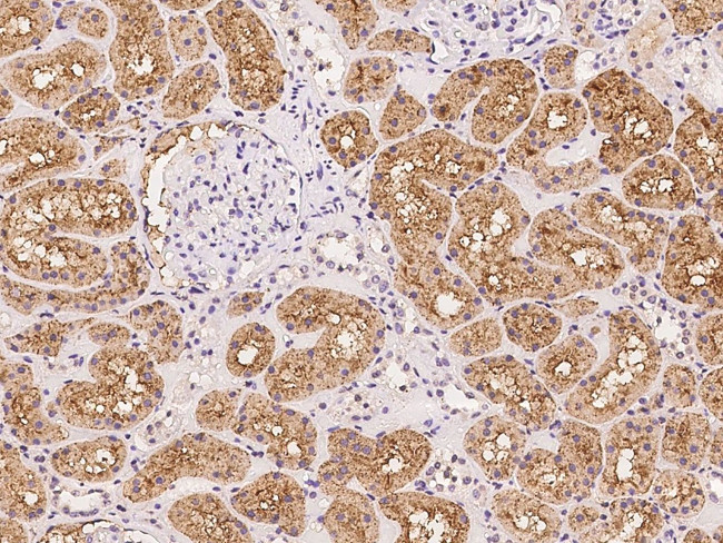 ANKS6 Antibody in Immunohistochemistry (Paraffin) (IHC (P))