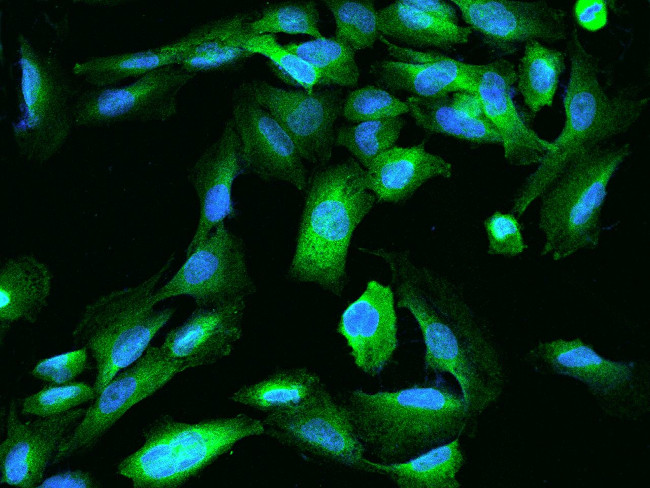 TEX264 Antibody in Immunocytochemistry (ICC/IF)