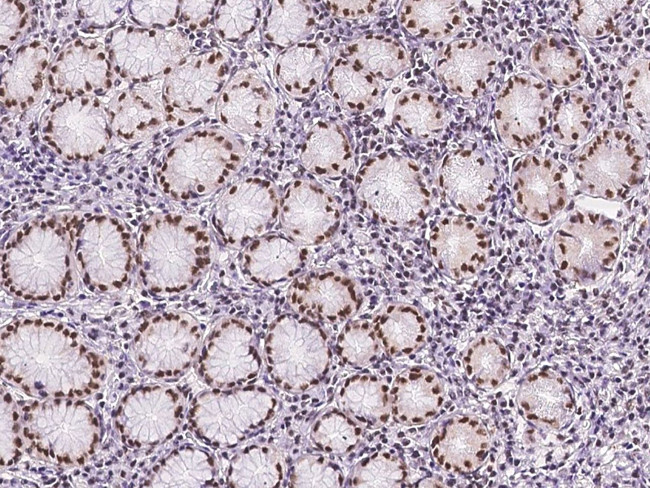 TPRX1 Antibody in Immunohistochemistry (Paraffin) (IHC (P))